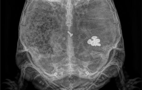 Sandhole vets in snodland undergo life saving surgery after a tortoise swallows 6 screws